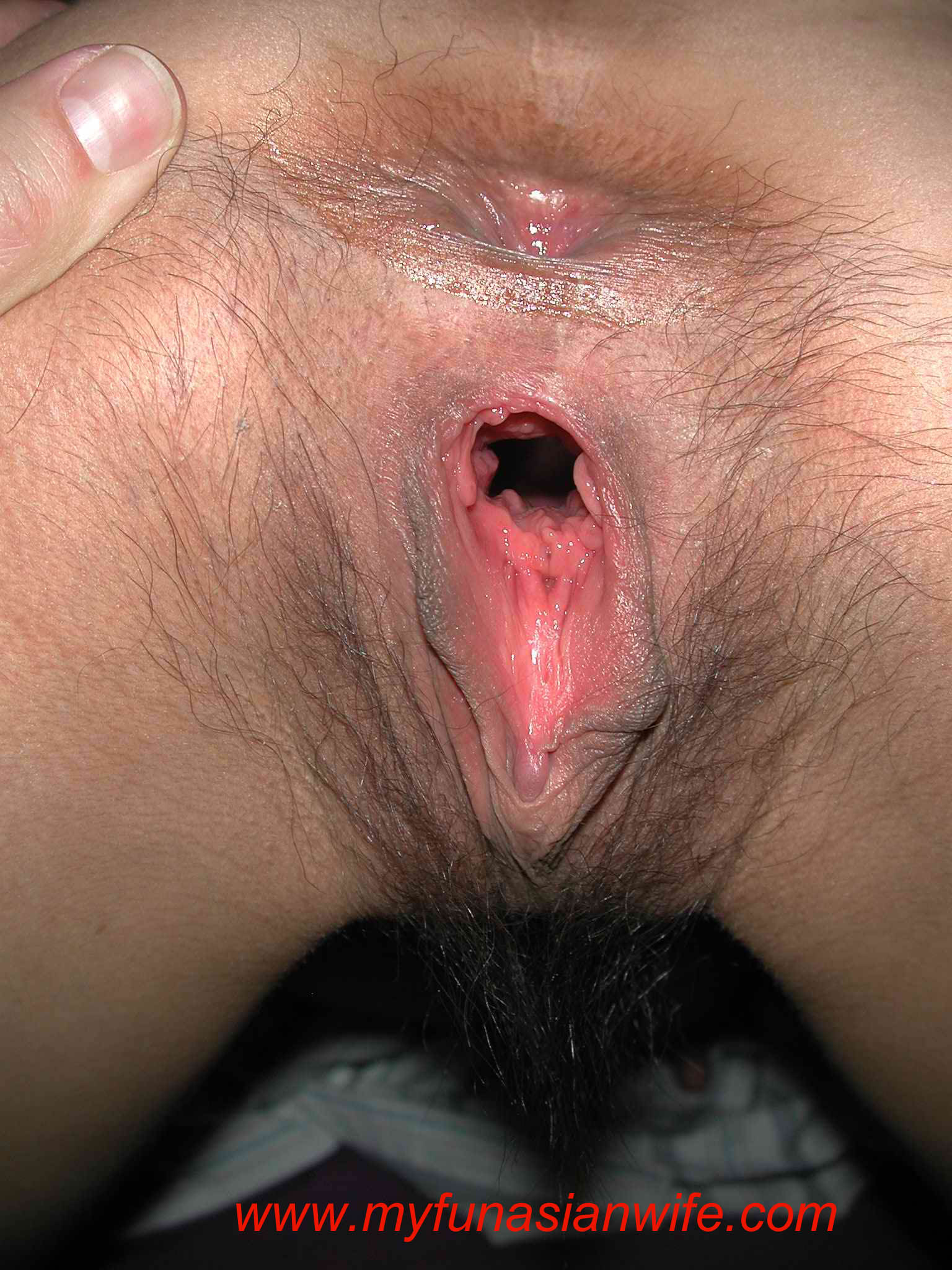 15_gape